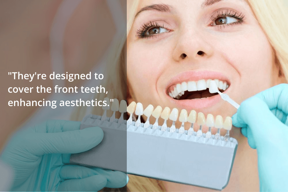 A dentist shows a patient a shade guide for porcelain veneers, illustrating how they can cover and aesthetically enhance front teeth, even addressing issues like missing teeth.