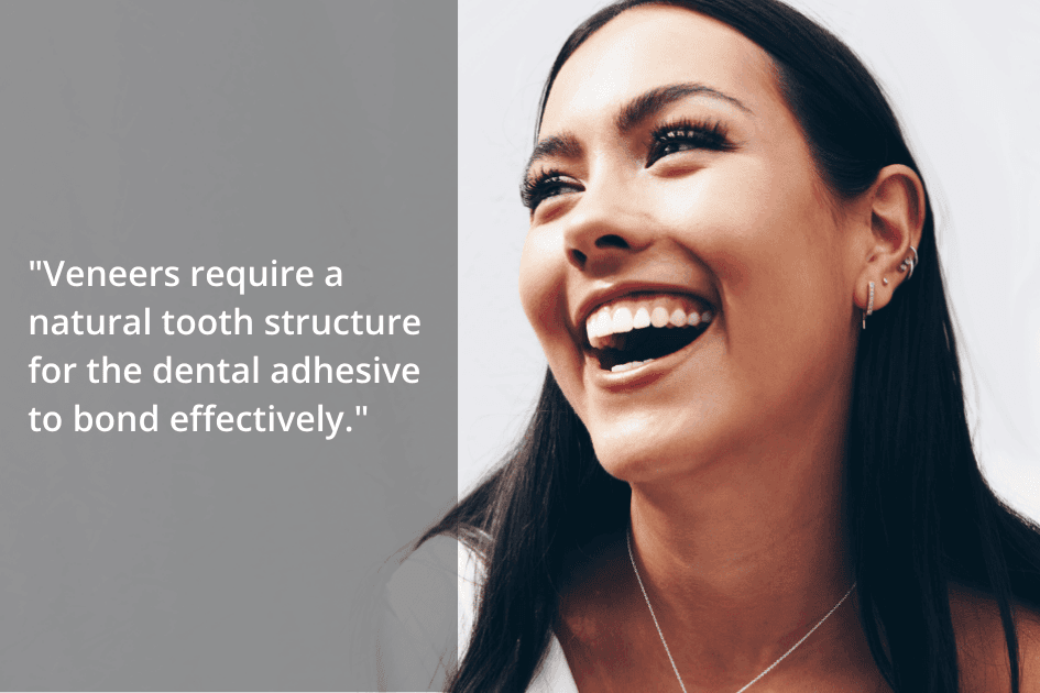 A woman smiles broadly, displaying her teeth. To her left, text reads: "Porcelain veneers require a natural tooth structure for the dental adhesive to bond effectively.