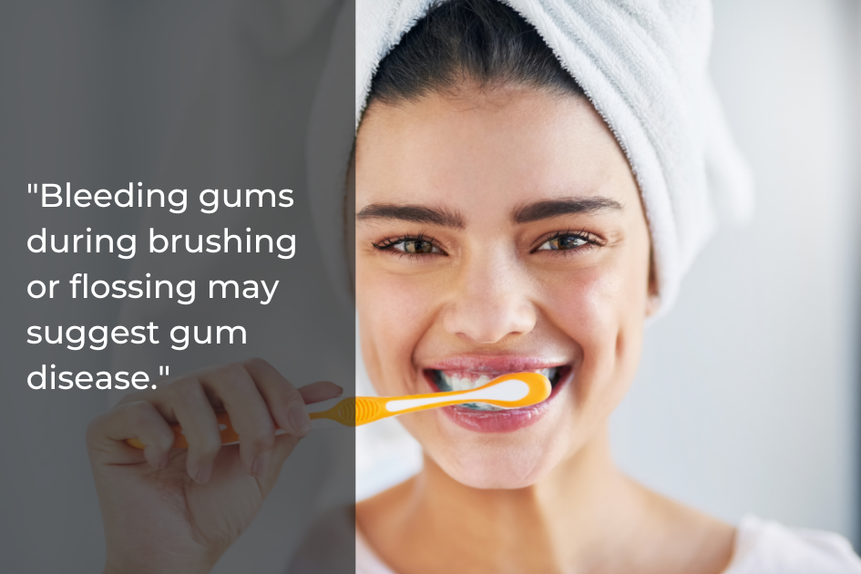 A woman with a towel on her head is brushing her teeth and smiling; a text overlay discusses bleeding gums as a sign of gum disease and highlights the importance of regular dental visits to maintain good oral health.